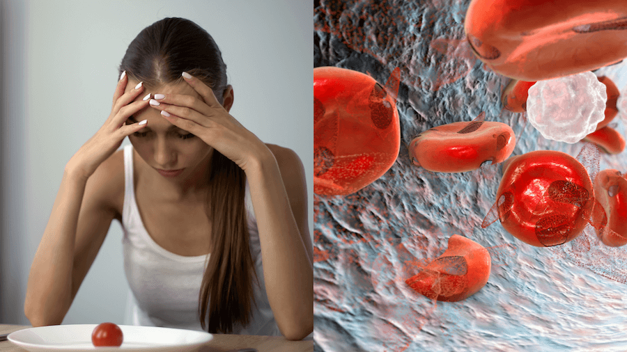 Hidden Dangers of Anemia, Symptoms, Causes, and Treatments
